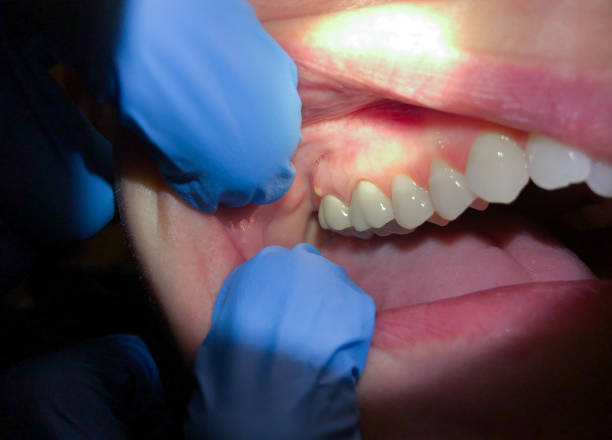 Best Emergency Dental Surgery in Carterville, MO